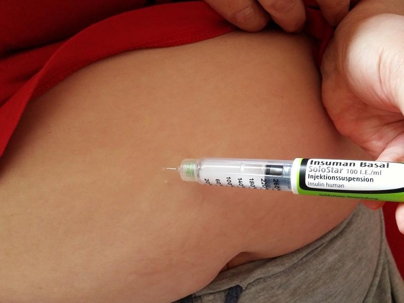 Bauchfalte, in die mit einer Nadel Insulin gespritzt wird. © pixabay/peter-facebook. 